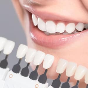 How to choose the best Teeth Whitening?