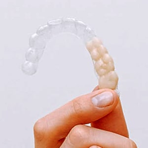 5 Smile Flaws That Invisalign Treatment Can Fix | Glendale