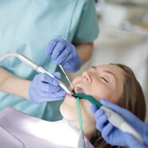 Root Canal Symptoms: 5 Ways to Tell If You Need a Root Canal in Glendale CA