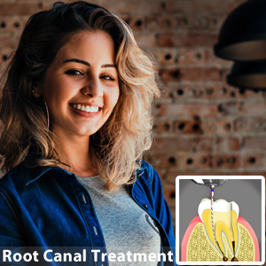 8 Reasons You Need To Have Root Canal Treatment