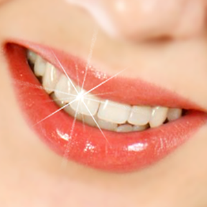 Teeth Whitening: To Do Or Not To Do?