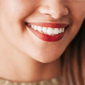 Debunking Myths About Teeth Whitening in Glendale